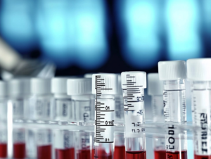 tubos com exame de sangue